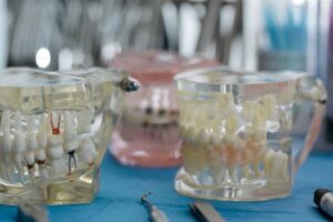 Dental models with teeth arrangement on a table, ideal for health and education visuals.